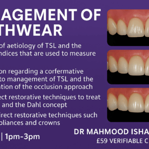 Management of Toothwear