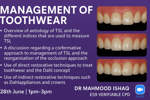 Management of Toothwear